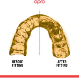 OPRO INSTANT CUSTOM FIT UFC STRIKE WHITE GOLD BACK SIDE